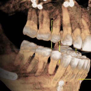 Cone Beam Directed Surgery
